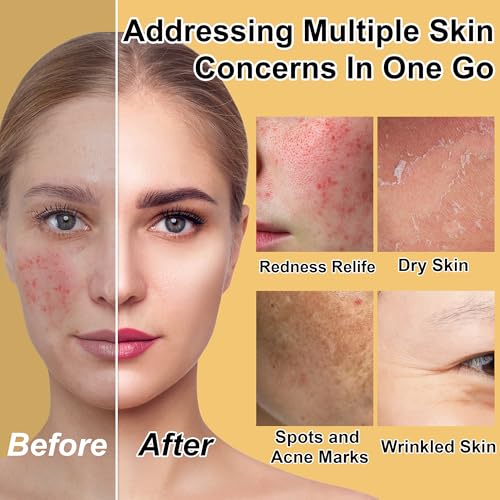 Skin Care Set for Teens Womens,Anti-Aging Deeply Hydrates Repairs Skincare Gift Set for All Skin,Facial Skin Care Products Routine Kit Christmas Beauty Gift Set for Women Stocking Stuffers - Image 3